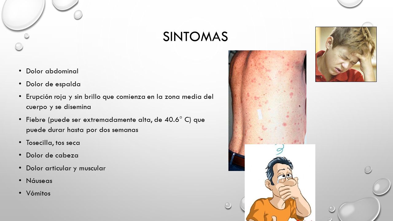 Fiebre las seca tos articulaciones en dolor